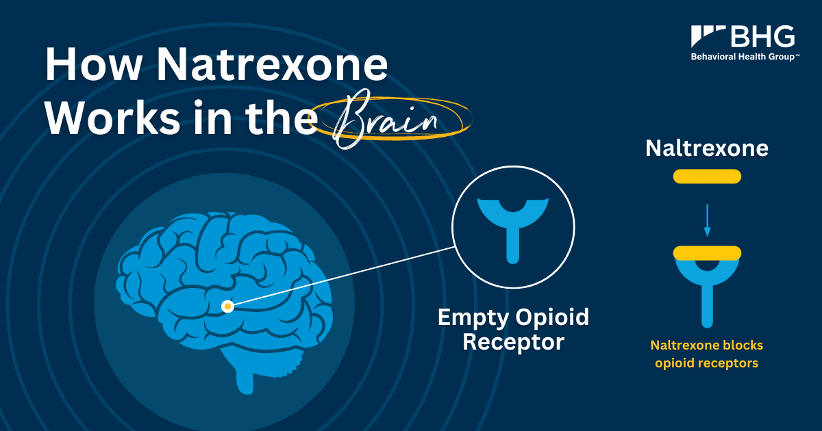 Educational graphic titled "How Naltrexone Works in the Brain," showing a brain illustration and a visual of naltrexone blocking opioid receptors to prevent the effects of opioids.