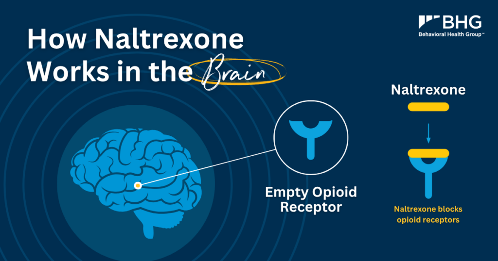 Diagram showing how naltrexone blocks opioid receptors in the brain to treat addiction.