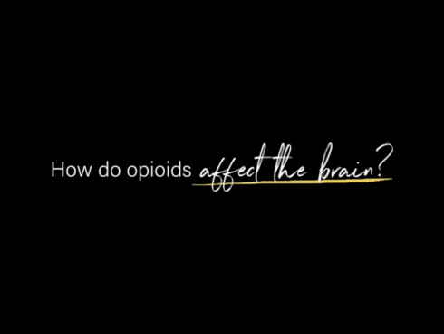 BHG’s Chief Medical Officer, Dr. Ben Nordstrom, explaining how opioids interact with the brain, affecting mood, reward pathways, and risk of addiction.