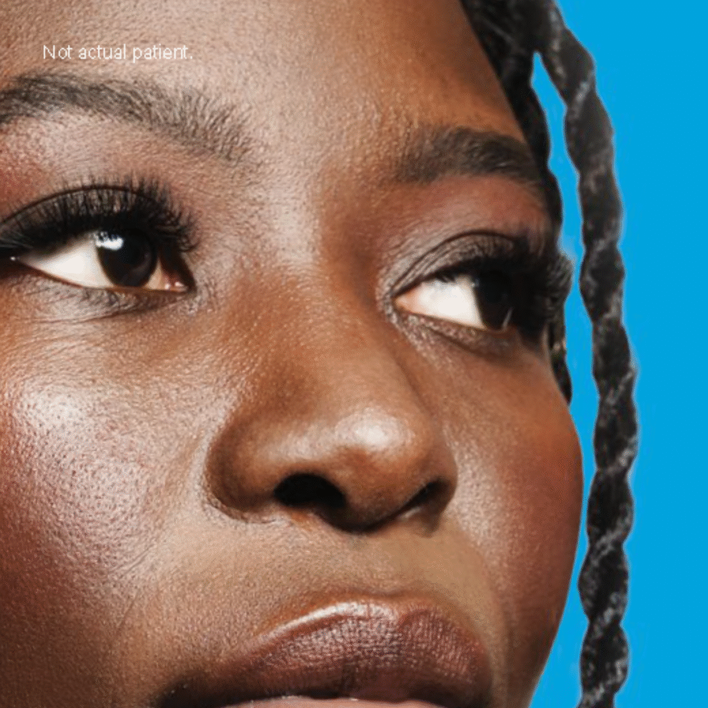 Close-up of person's face against blue background with braided hair, disclaimer Not actual patient.